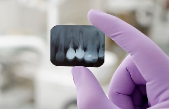 Рентген зуба в Красноярске