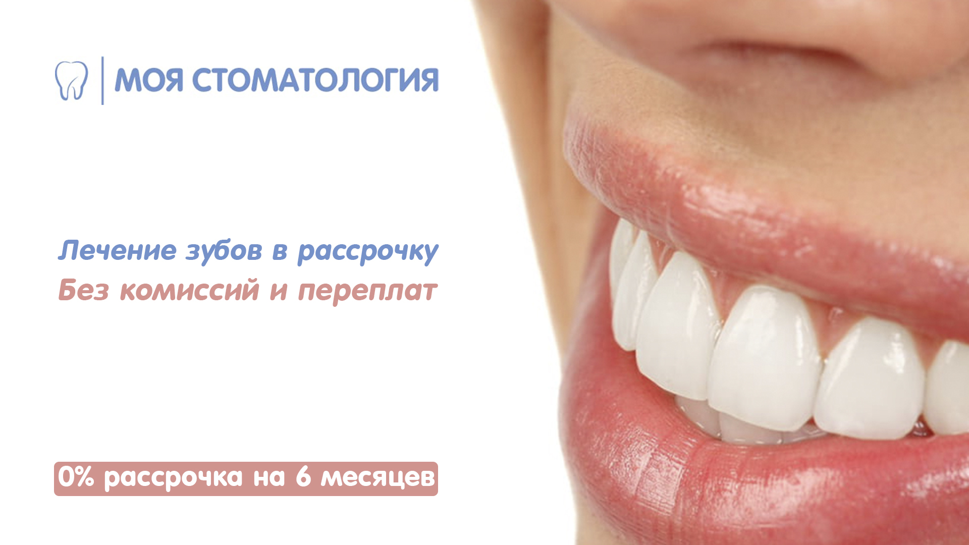 лечение зубов в рассрочку красноярск